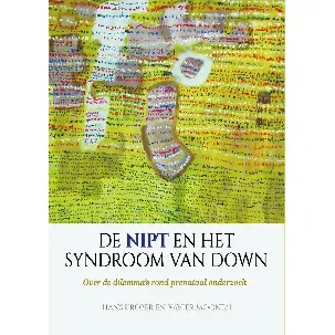 Afbeelding van De NIPT en het syndroom van Down