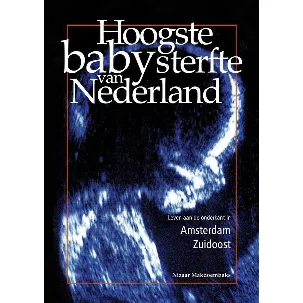 Afbeelding van Hoogste babysterfte van Nederland